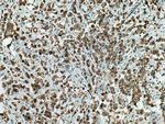 PTPLAD1 Antibody in Immunohistochemistry (Paraffin) (IHC (P))