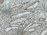 KIF23 Antibody in Immunohistochemistry (Paraffin) (IHC (P))