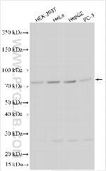 TMEM200C Antibody in Western Blot (WB)
