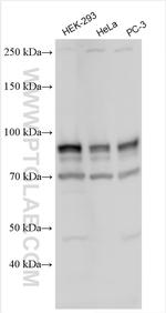 DYRK1A Antibody in Western Blot (WB)