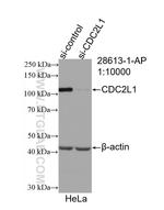 CDC2L1 Antibody in Western Blot (WB)