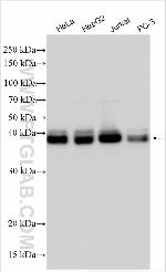 KLHL32 Antibody in Western Blot (WB)