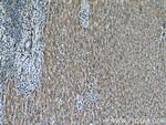 BCAT1 Antibody in Immunohistochemistry (Paraffin) (IHC (P))