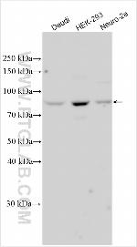 SARM1 Antibody in Western Blot (WB)