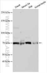 SARM1 Antibody in Western Blot (WB)