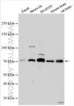SARM1 Antibody in Western Blot (WB)