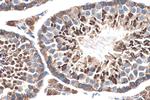 XPO5 Antibody in Immunohistochemistry (Paraffin) (IHC (P))