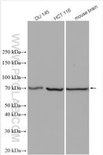 TCTN1 Antibody in Western Blot (WB)
