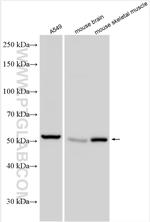 SLC38A1 Antibody in Western Blot (WB)