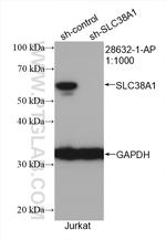 SLC38A1 Antibody in Western Blot (WB)