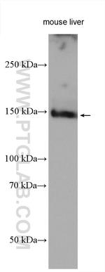 C15orf55 Antibody in Western Blot (WB)