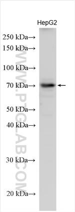 CCDC60 Antibody in Western Blot (WB)
