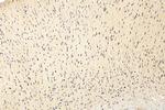 VPS33B Antibody in Immunohistochemistry (Paraffin) (IHC (P))