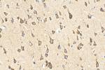 VPS33B Antibody in Immunohistochemistry (Paraffin) (IHC (P))