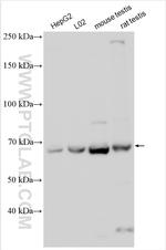 VPS33B Antibody in Western Blot (WB)