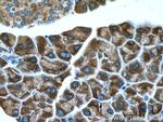 SEC63 Antibody in Immunohistochemistry (Paraffin) (IHC (P))
