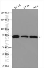 TRABD2B Antibody in Western Blot (WB)