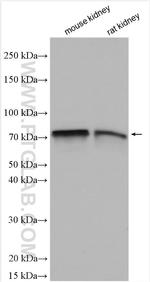 SGLT2 Antibody in Western Blot (WB)
