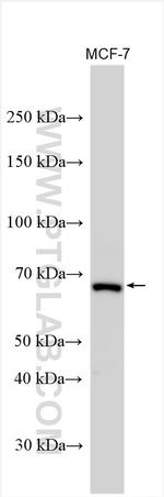 SETD3 Antibody in Western Blot (WB)