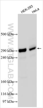 KNL1 Antibody in Western Blot (WB)
