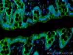 LAMA1 Antibody in Immunohistochemistry (Paraffin) (IHC (P))