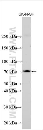 LAMA1 Antibody in Western Blot (WB)