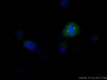 CEP192 Antibody in Immunocytochemistry (ICC/IF)