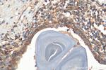 MUC4 Antibody in Immunohistochemistry (Paraffin) (IHC (P))