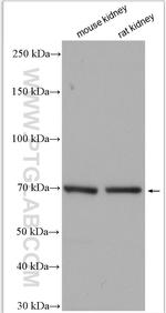 SCNN1A Antibody in Western Blot (WB)
