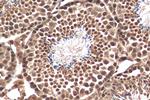 TAF9B Antibody in Immunohistochemistry (Paraffin) (IHC (P))