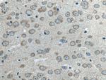 ALG13 Antibody in Immunohistochemistry (Paraffin) (IHC (P))