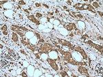 MDMX Antibody in Immunohistochemistry (Paraffin) (IHC (P))