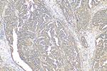 MDMX Antibody in Immunohistochemistry (Paraffin) (IHC (P))