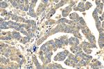 MDMX Antibody in Immunohistochemistry (Paraffin) (IHC (P))