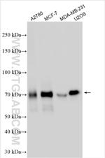 MDMX Antibody in Western Blot (WB)