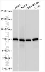 MDMX Antibody in Western Blot (WB)