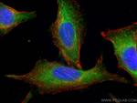 PLK4 Antibody in Immunocytochemistry (ICC/IF)