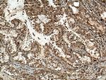 PLK4 Antibody in Immunohistochemistry (Paraffin) (IHC (P))