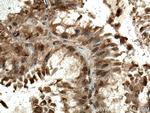 PLK4 Antibody in Immunohistochemistry (Paraffin) (IHC (P))