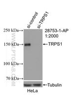 TRPS1 Antibody in Western Blot (WB)