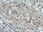 UCKL1 Antibody in Immunohistochemistry (Paraffin) (IHC (P))
