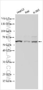UCKL1 Antibody in Western Blot (WB)