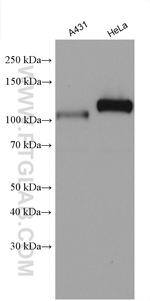 KAT2B Antibody in Western Blot (WB)