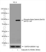 Phospho-Beta Catenin (Ser33) Antibody in Western Blot (WB)