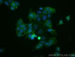 Phospho-Beta Catenin (Ser552) Antibody in Immunocytochemistry (ICC/IF)