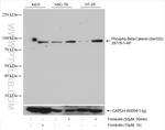 Phospho-Beta Catenin (Ser552) Antibody in Western Blot (WB)