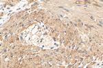 USP25 Antibody in Immunohistochemistry (Paraffin) (IHC (P))