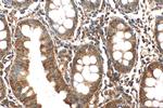 USP25 Antibody in Immunohistochemistry (Paraffin) (IHC (P))