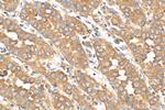 USP25 Antibody in Immunohistochemistry (Paraffin) (IHC (P))