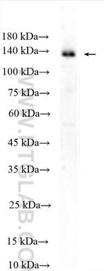 USP25 Antibody in Western Blot (WB)